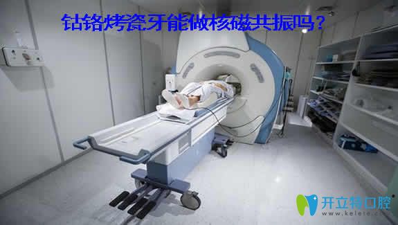 良心牙醫(yī)解析：鈷鉻烤瓷牙能做核磁共振嗎？