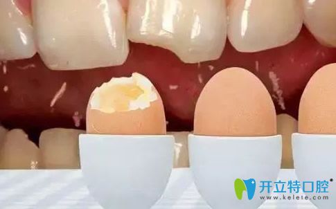 洗牙把牙釉質(zhì)破壞了，聽說牙釉質(zhì)有再生功能這是真的嗎？