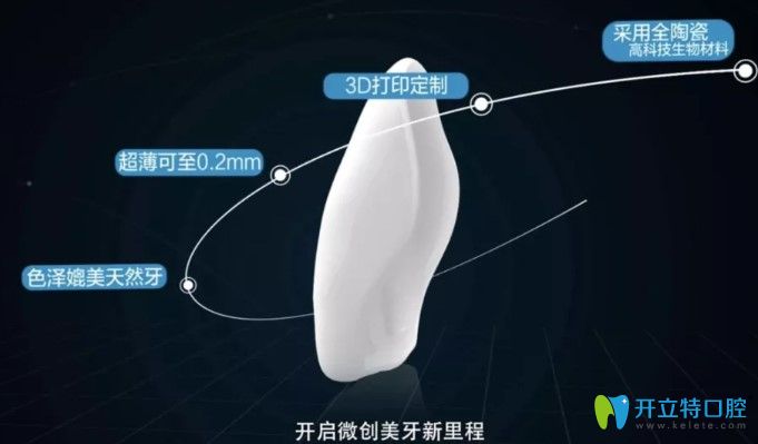 剛開始做的牙齒貼面很失敗，又進(jìn)行了二次瓷貼面修復(fù)