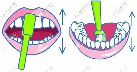 刷門牙的時(shí)候要把牙刷豎起來(lái)