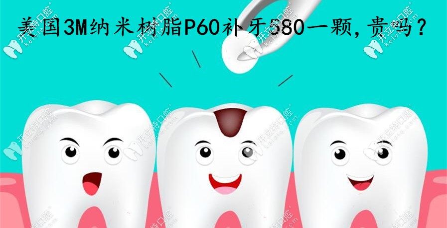 在煙臺做美國3MP60納米樹脂補牙580一顆，這費用算貴嗎