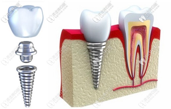 劉洪飛主任的擅長領(lǐng)域介紹