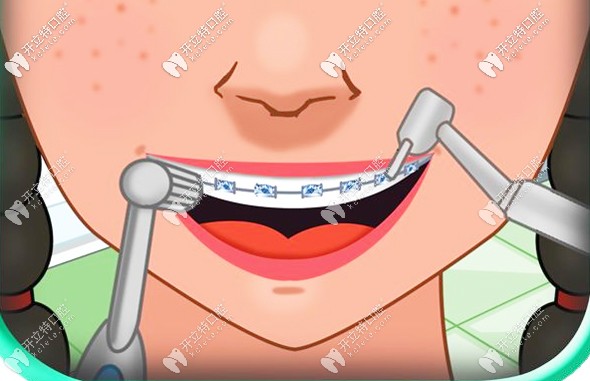 關于西寧牙齒矯正