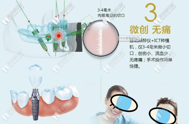 微創(chuàng)種植牙技術