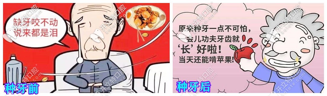 種牙前后對比
