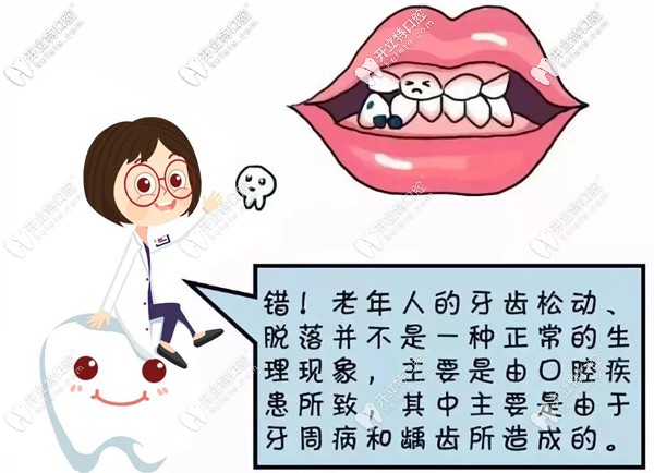 50歲全口牙松動(dòng)，做即拔即種即刻負(fù)重全口種植牙吃飯香啦~