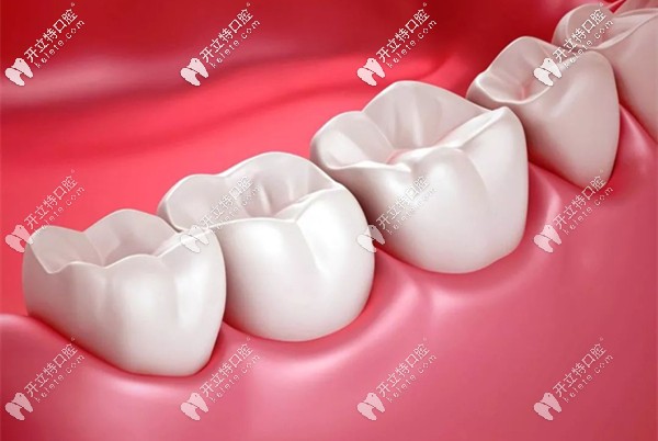 選全瓷牙冠是國產(chǎn)1600元的好還是進(jìn)口2000元好,其實(shí)不用糾結(jié)