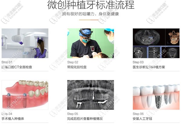 青島維樂口腔的微創(chuàng)種植牙標準流程